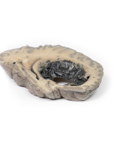 Emorragia cerebrale Erler Zimmer 3D anatomy Series MP2002