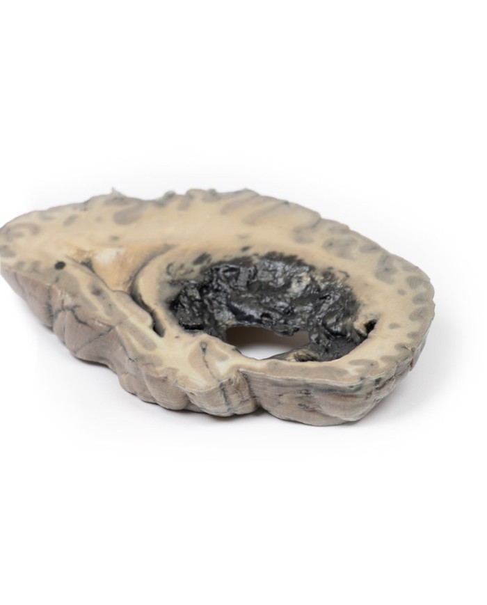 Emorragia cerebrale Erler Zimmer 3D anatomy Series MP2002