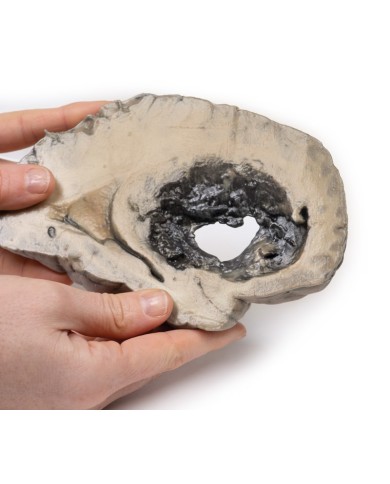 Emorragia cerebrale Erler Zimmer 3D anatomy Series MP2002