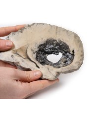 Emorragia cerebrale Erler Zimmer 3D anatomy Series MP2002