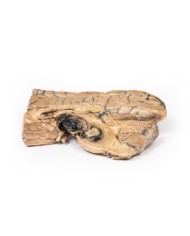 Aneurisma di Berry dell arteria basilare Erler Zimmer 3D anatomy Series M Aneurisma di Berry dell arteria basilare Erler Zimmer 3D anatomy Series M