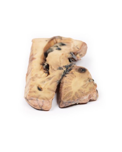 Aneurisma di Berry dell arteria basilare Erler Zimmer 3D anatomy Series M