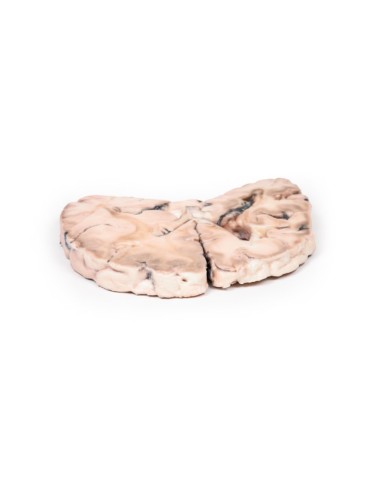 Infarto cerebrale sinistro Erler Zimmer 3D anatomy Series MP2005