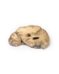 Adenocarcinoma metastatico nel cervello Erler Zimmer 3D anatomy Series MP Adenocarcinoma metastatico nel cervello Erler Zimmer 3D anatomy Series MP