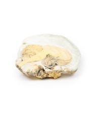 Adenoma ipofisario Erler Zimmer 3D anatomy Series MP2006 Adenoma ipofisario Erler Zimmer 3D anatomy Series MP2006