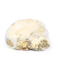 Adenoma ipofisario Erler Zimmer 3D anatomy Series MP2006 Adenoma ipofisario Erler Zimmer 3D anatomy Series MP2006