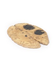 Emorragia cerebrale secondaria a leucemia mieloide acuta Erler Zimmer 3D Emorragia cerebrale secondaria a leucemia mieloide acuta Erler Zimmer 3D