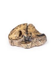 Lesione intracranica Erler Zimmer 3D anatomy Series MP2011 Lesione intracranica Erler Zimmer 3D anatomy Series MP2011