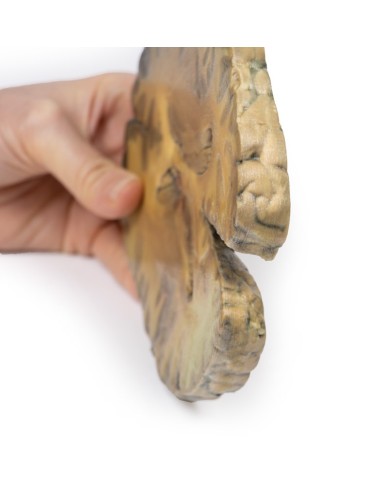 Ventricolite secondaria a setticemia Erler Zimmer 3D anatomy Series MP20