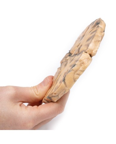 Astrocitoma Erler Zimmer 3D anatomy Series MP2014 Astrocitoma Erler Zimmer 3D anatomy Series MP2014