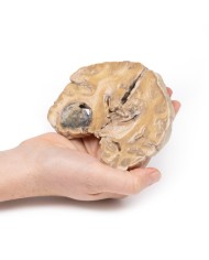 Glioblastoma multiforme Erler Zimmer 3D anatomy Series MP2015 Glioblastoma multiforme Erler Zimmer 3D anatomy Series MP2015