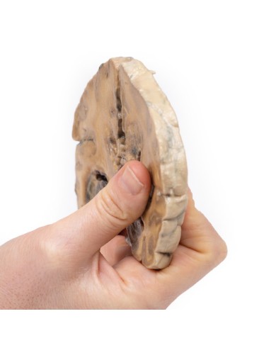 Glioblastoma multiforme Erler Zimmer 3D anatomy Series MP2015 Glioblastoma multiforme Erler Zimmer 3D anatomy Series MP2015