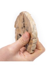 Glioblastoma multiforme Erler Zimmer 3D anatomy Series MP2015 Glioblastoma multiforme Erler Zimmer 3D anatomy Series MP2015