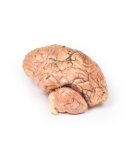 Craniofaringioma Erler Zimmer 3D anatomy Series MP2017 Craniofaringioma Erler Zimmer 3D anatomy Series MP2017