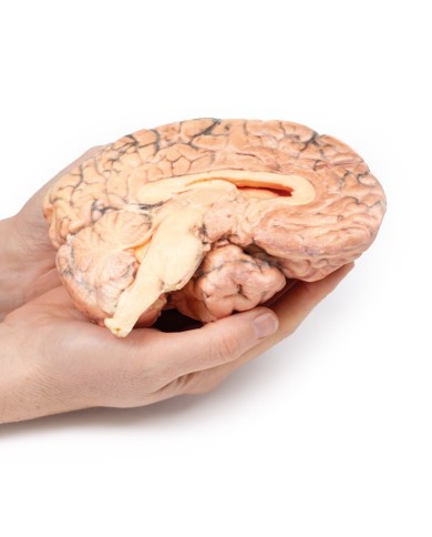 Craniofaringioma Erler Zimmer 3D anatomy Series MP2017 Craniofaringioma Erler Zimmer 3D anatomy Series MP2017