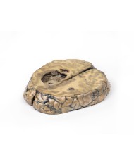 Carcinoma metastatico nel cervello Erler Zimmer 3D anatomy Series MP2019 Carcinoma metastatico nel cervello Erler Zimmer 3D anatomy Series MP2019