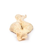 Aneurisma dell aorta addominale Erler Zimmer 3D anatomy Series MP2030