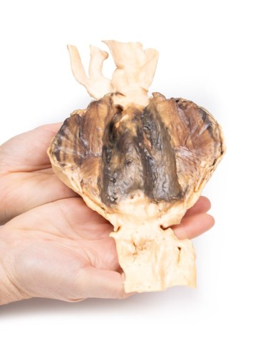 Aneurisma dell aorta addominale Erler Zimmer 3D anatomy Series MP2030