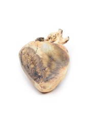 Difetto interatriale Erler Zimmer 3D anatomy Series MP2032