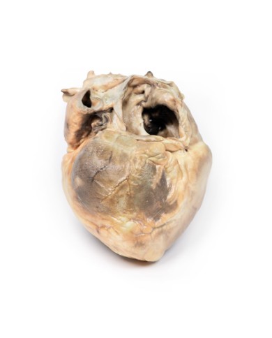 Difetto interatriale Erler Zimmer 3D anatomy Series MP2032