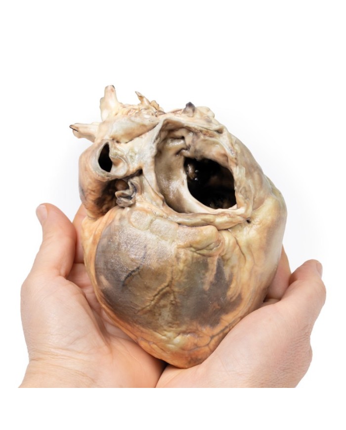 Difetto interatriale Erler Zimmer 3D anatomy Series MP2032