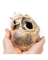 Difetto interatriale Erler Zimmer 3D anatomy Series MP2032