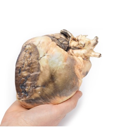 Difetto interatriale Erler Zimmer 3D anatomy Series MP2032