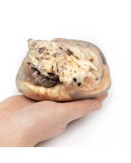 Difetto interatriale Erler Zimmer 3D anatomy Series MP2032