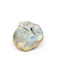 Ipertrofia ventricolare destra Erler Zimmer 3D anatomy Series MP2031