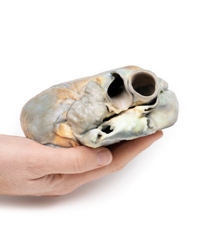 Ipertrofia ventricolare destra Erler Zimmer 3D anatomy Series MP2031