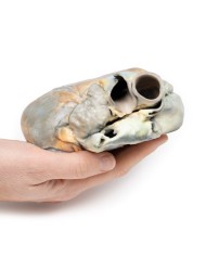 Ipertrofia ventricolare destra Erler Zimmer 3D anatomy Series MP2031