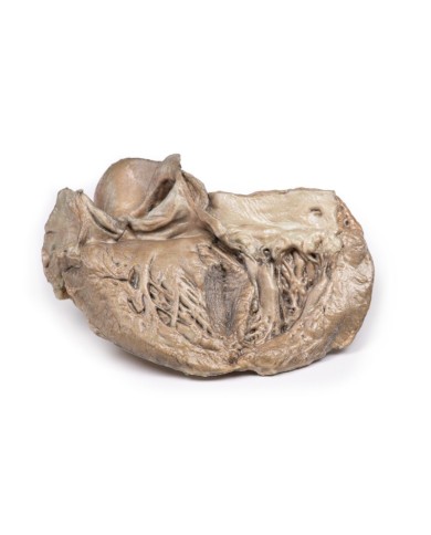 Valvola aortica bicuspide Erler Zimmer 3D anatomy Series MP2033