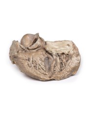 Valvola aortica bicuspide Erler Zimmer 3D anatomy Series MP2033