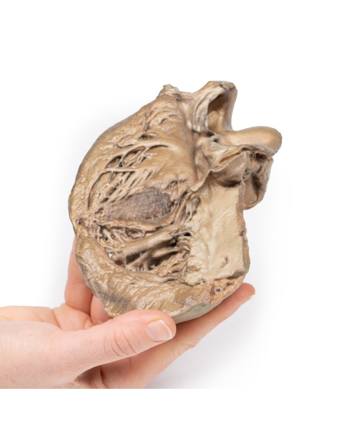 Valvola aortica bicuspide Erler Zimmer 3D anatomy Series MP2033