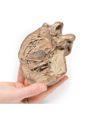 Valvola aortica bicuspide Erler Zimmer 3D anatomy Series MP2033