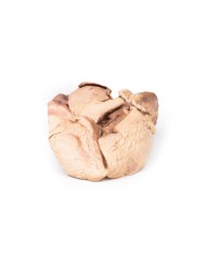 Endocardite reumatica Erler Zimmer 3D anatomy Series MP2039