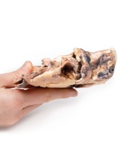 Endocardite reumatica Erler Zimmer 3D anatomy Series MP2039