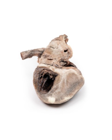 Tetralogia di Fallot Erler Zimmer 3D anatomy Series MP2037