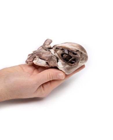 Tetralogia di Fallot Erler Zimmer 3D anatomy Series MP2037