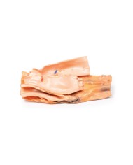 Fistola traumatica esofageo aortica Erler Zimmer 3D anatomy Series MP2040