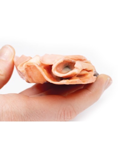 Fistola traumatica esofageo aortica Erler Zimmer 3D anatomy Series MP2040