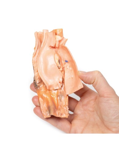 Fistola traumatica esofageo aortica Erler Zimmer 3D anatomy Series MP2040