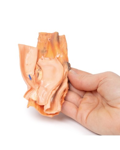 Fistola traumatica esofageo aortica Erler Zimmer 3D anatomy Series MP2040