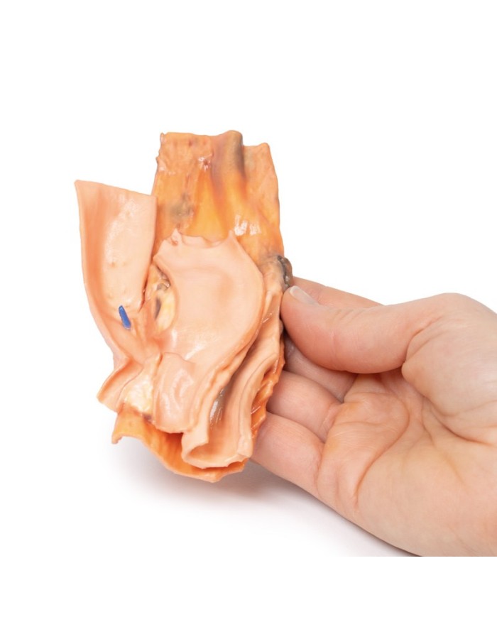 Fistola traumatica esofageo aortica Erler Zimmer 3D anatomy Series MP2040