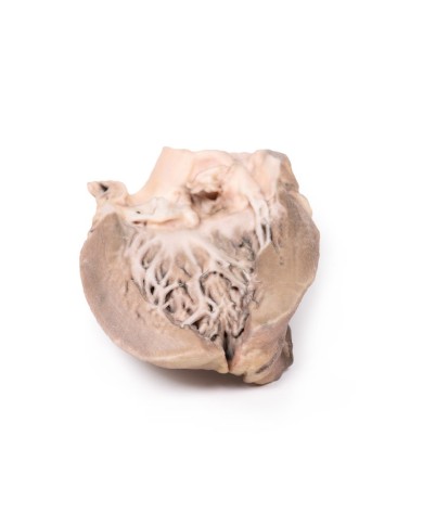 Endocardite batterica acuta Erler Zimmer 3D anatomy Series MP2041