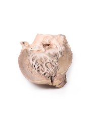 Endocardite batterica acuta Erler Zimmer 3D anatomy Series MP2041