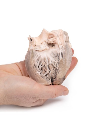 Endocardite batterica acuta Erler Zimmer 3D anatomy Series MP2041