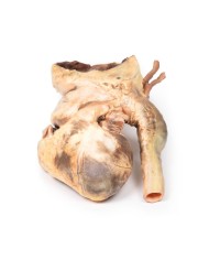 Aneurisma sifilitico Erler Zimmer 3D anatomy Series MP2042