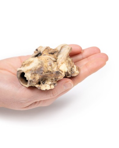 Carcinoma della fossa piriforme Erler Zimmer 3D anatomy Series MP2051