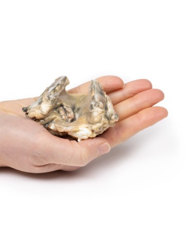 Carcinoma della laringe Erler Zimmer 3D anatomy Series MP2052